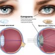 Враги зрения: Катаракта и глаукома
